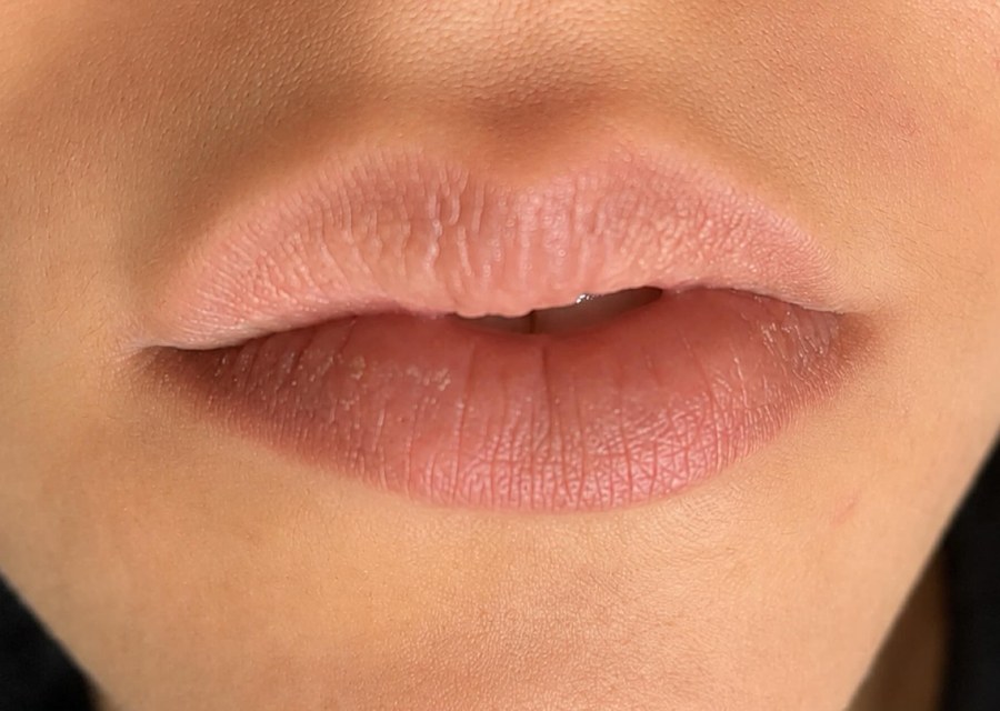 Antes da micropigmentação labial