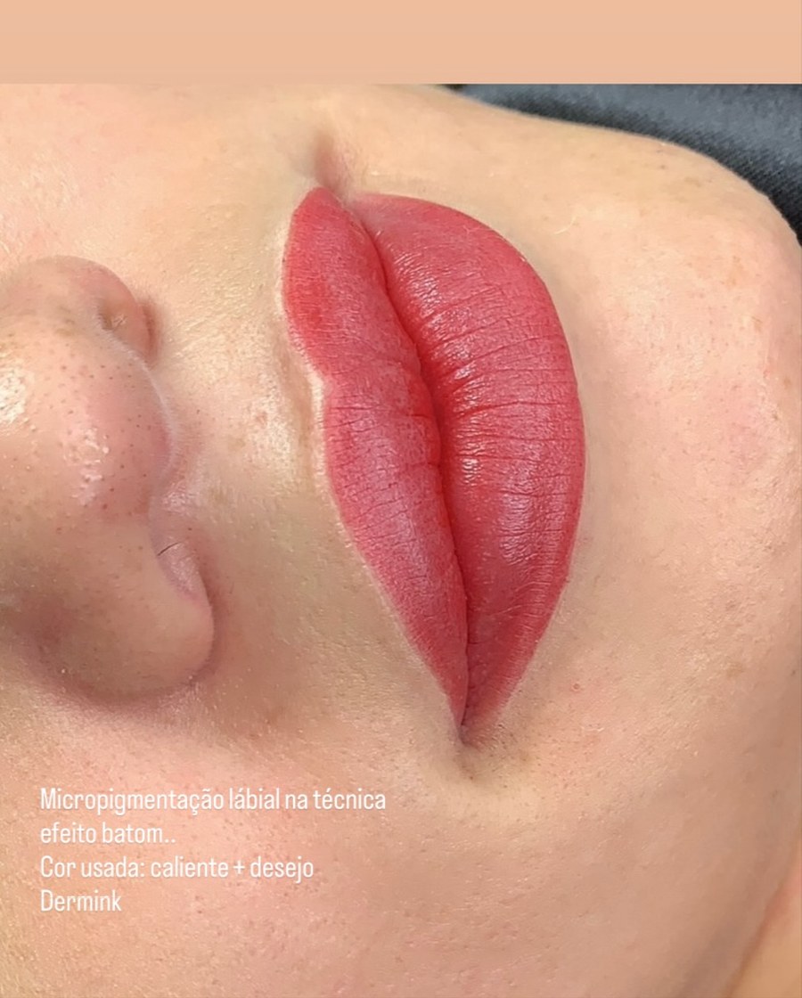 Resultado de micropigmentação labial efeito batom